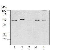 RPS1 | Ribosomal protein S1 (chloroplastic) in the group Antibodies Plant/Algal / DNA/RNA/Cell Cycle / Translation at Agrisera AB (Antibodies for research) (AS15 2875)